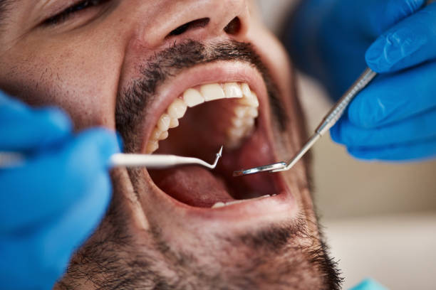 Best Emergency Dentist for Special Needs Patients in Hoffman Estates, IL