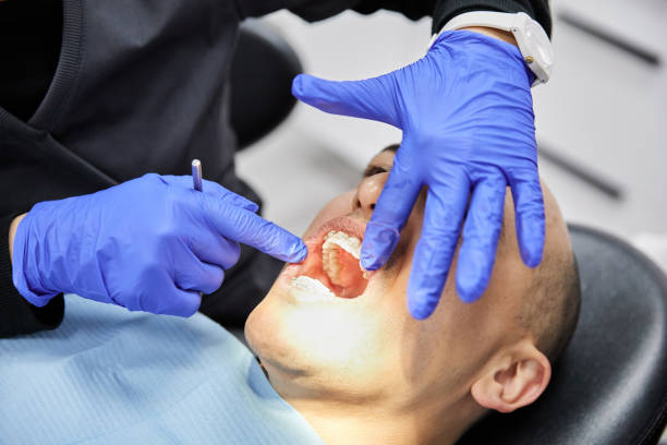 Best Emergency Dental Extractions in Hoffman Estates, IL